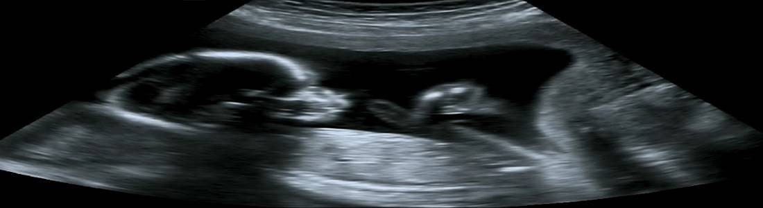 Pregnancy and Ultrasounds: Helping Modern Women - Post banner