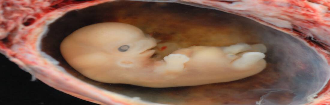 Sample Essay on the Effects of Various Substances on Fetal Development - Post banner